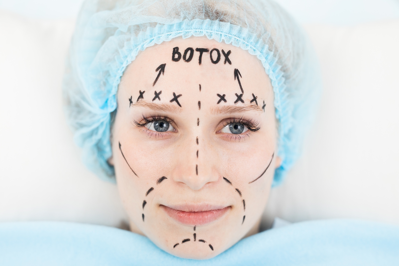 The appearance of eyebrow before and after Botox Brow Lift