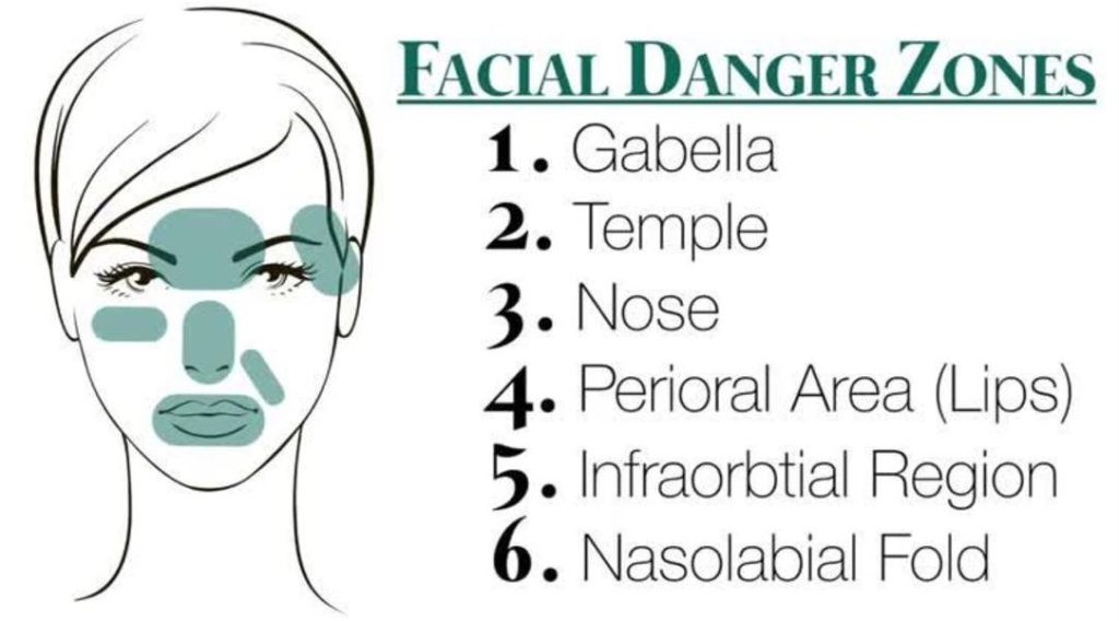 Botox Danger Zones Map
