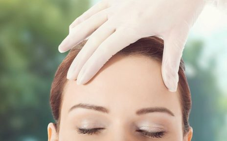 Trichophytic Brow Lift