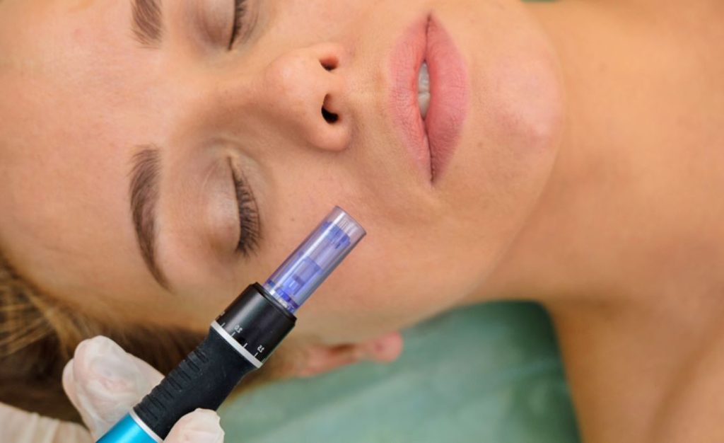 Newsletter Feature Block PRF